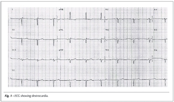 Myocardial revascularization in a patient with situs inversus totalis