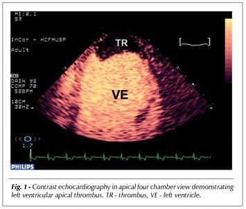 Clinical use of contrast echocardiography with microbubble-based