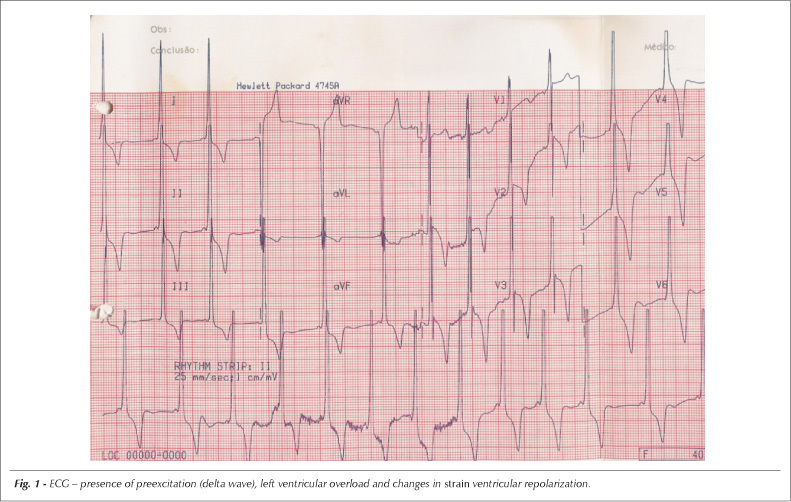 Case 4/2007: a 21 year-old woman with hypertrophic cardiomyopathy who presented hemorrhagic shock and disseminated intravascular coagulation following oophorectomy due to ovarian cyst rupture
