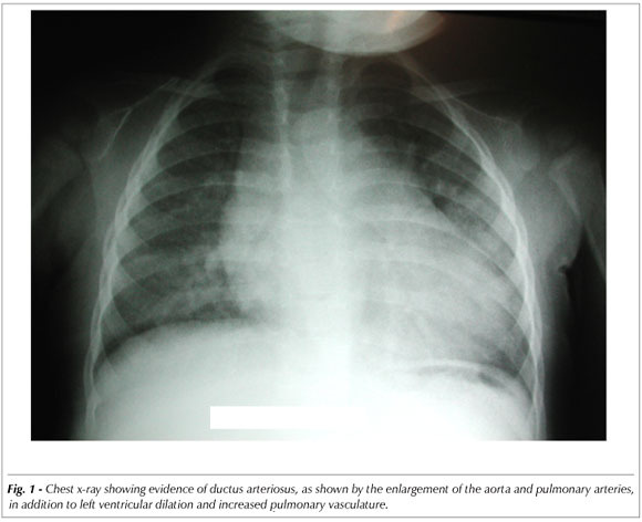 Case 4/2007: a sixteen-month-old infant with patent ductus arteriosus