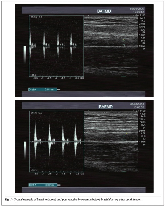 Reliability of brachial artery flow-mediated dilatation measurement using ultrasound