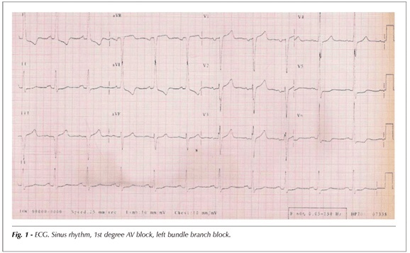 Case 5/2007: a 71 year-old diabetic and hypertensive female with left ventricular hypertrophy and epigastric pain