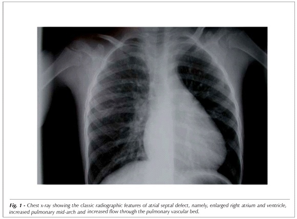 Case 5/2007: a five-year-old child with atrial septal defect