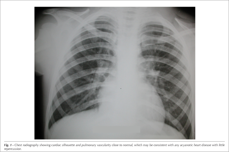 Case 6/2007: a ten-year-old child with mild pulmonary valve stenosis