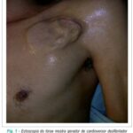 Imagem 1 da galeria