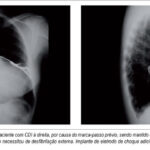Imagem 3 da galeria