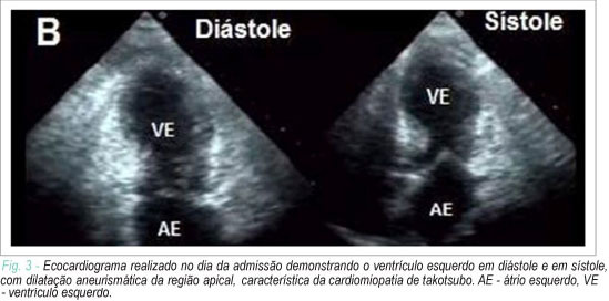 Imagem 3 da galeria