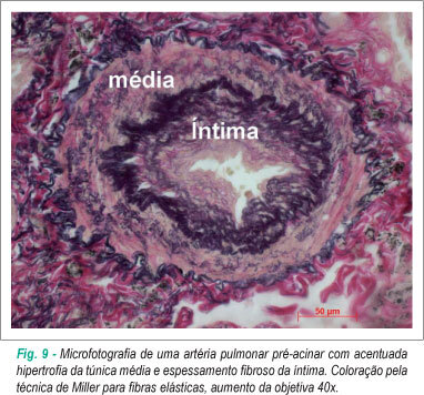 Imagem 9 da galeria