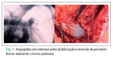 Imagem 3 da galeria