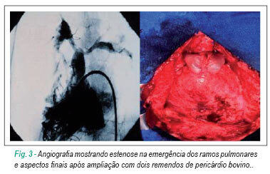 Imagem 5 da galeria