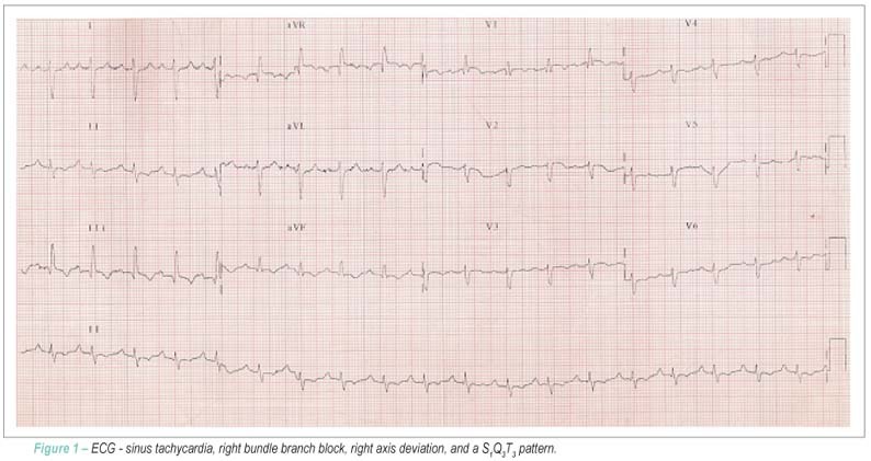 Case 4: a 78-year-old obese woman with sudden-onset dyspnea