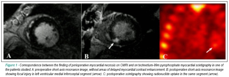 Magnetic resonance vs technetium-99m pyrophosphate scintigraphy in the detection of perioperative myocardial necrosis