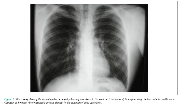 Case 4/2008: a 15-year-old male adolescent with accentuated isthmic coarctation of the aorta