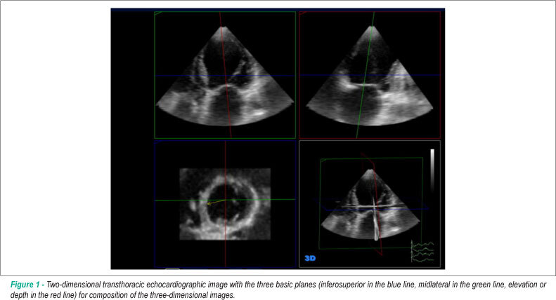 Ventricular dyssynchrony index: comparison with two-dimensional and three-dimensional ejection fraction