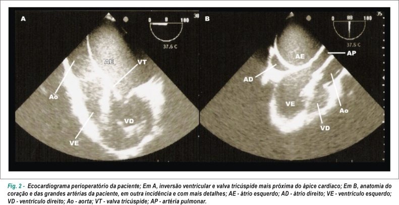Imagem 2 da galeria