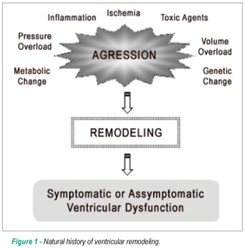 Ventricular remodeling after myocardial infarction: concepts and clinical implications