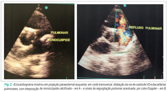 Imagem 2 da galeria
