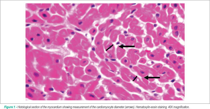 The myocardium in tetralogy of Fallot: a histological and morphometric study