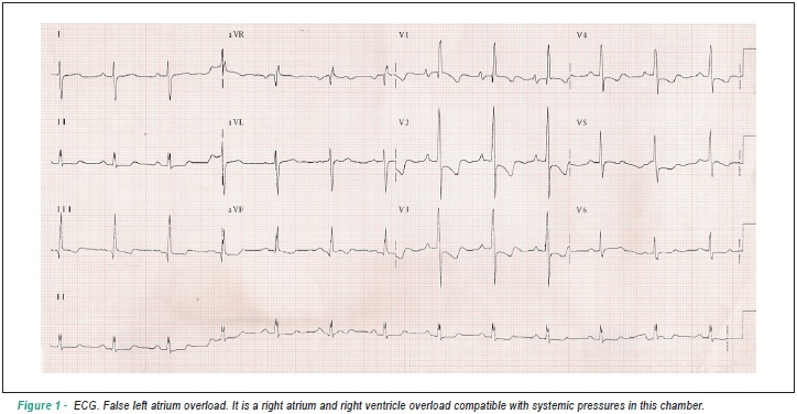Case 1/2009 - a 33-year-old man with effort dyspnea and syncope who presented sudden worsening of the dyspnea