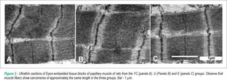 Effect of exercise training on aging-induced changes in rat papillary muscle