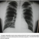 Imagem 1 da galeria