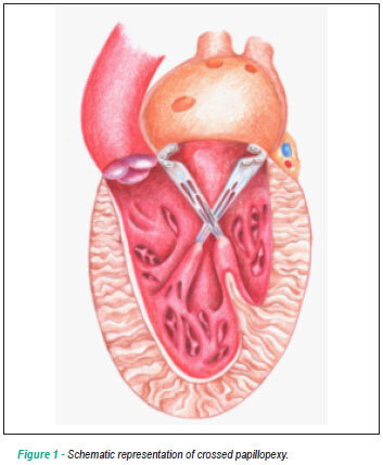 Echocardiographic evaluation of patients undergoing mitral valve replacement with crossed papillopexy