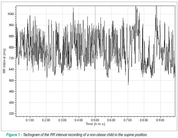 Heart rate variability, blood lipids and physical capacity of obese and non-obese children