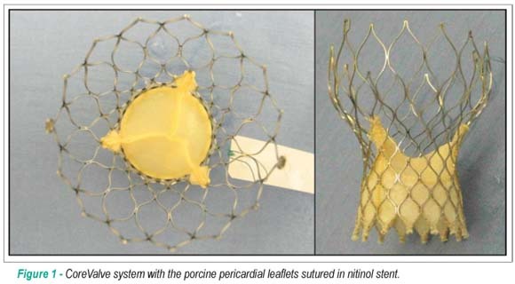 Percutaneous aortic valve replacement for the treatment of aortic stenosis: early experience in Brazil