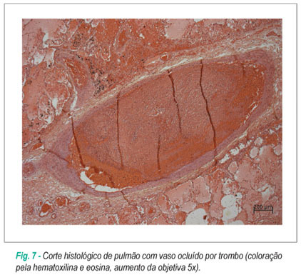 Imagem 5 da galeria