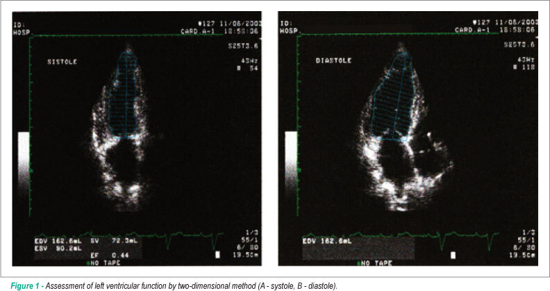 Echocardiography in cardiac resynchronization therapy