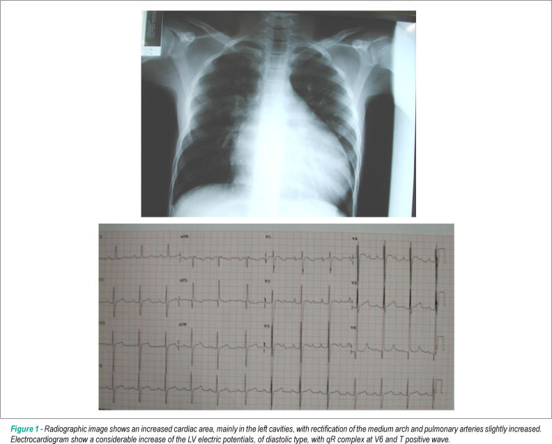 Case 6/2009: 13 years old youngsters with major atrial and ventricular septal defects