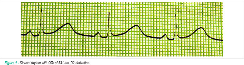 Postpartum torsades de pointes and long QT syndrome