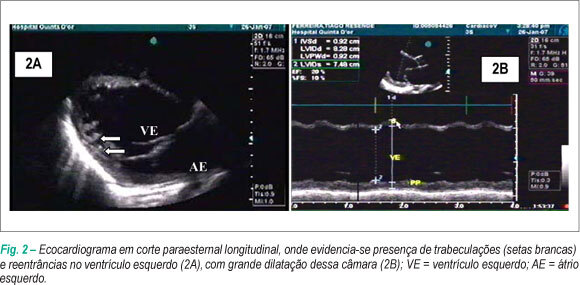 Imagem 2 da galeria