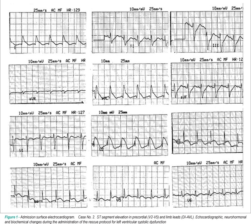 Antiadrenergic rescue therapy with amiodarone in children with severe left ventricular dysfunction secondary to scorpion envenomation