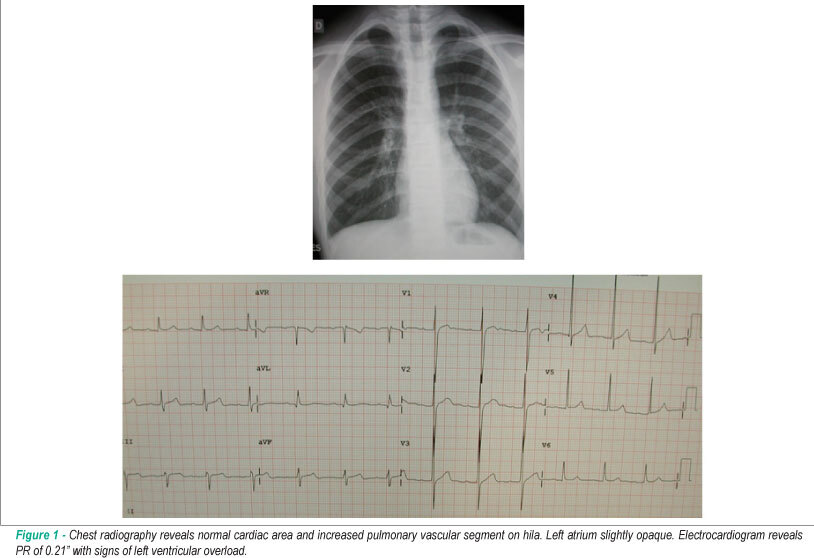 Case 1/2010 - 15 year-old male adolescent with isolated cleft in anterior mitral valve