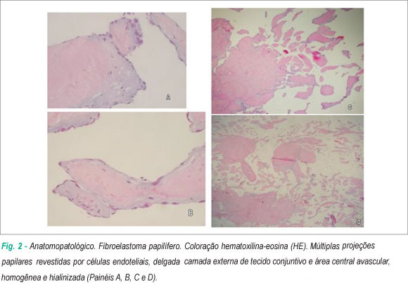 Imagem 2 da galeria