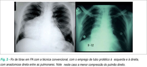 Imagem 2 da galeria