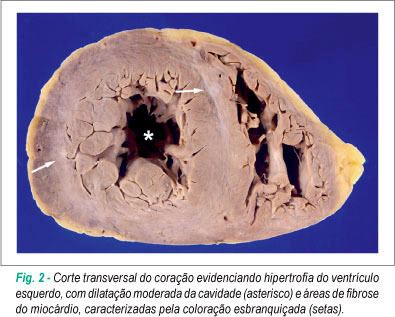 Imagem 2 da galeria