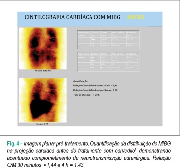 Imagem 4 da galeria