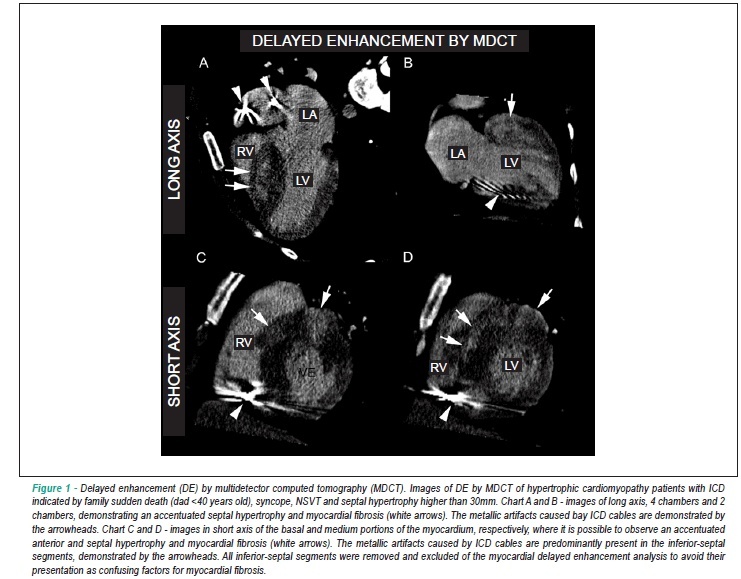 Myocardial fibrosis in patients with hypertrophic cardiomyopathy and high risk for sudden death