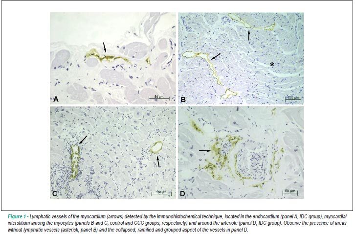 Quantification of lymphatic vessels in dilated and chronic chagasic cardiomyopathy