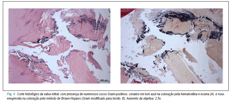 Imagem 3 da galeria