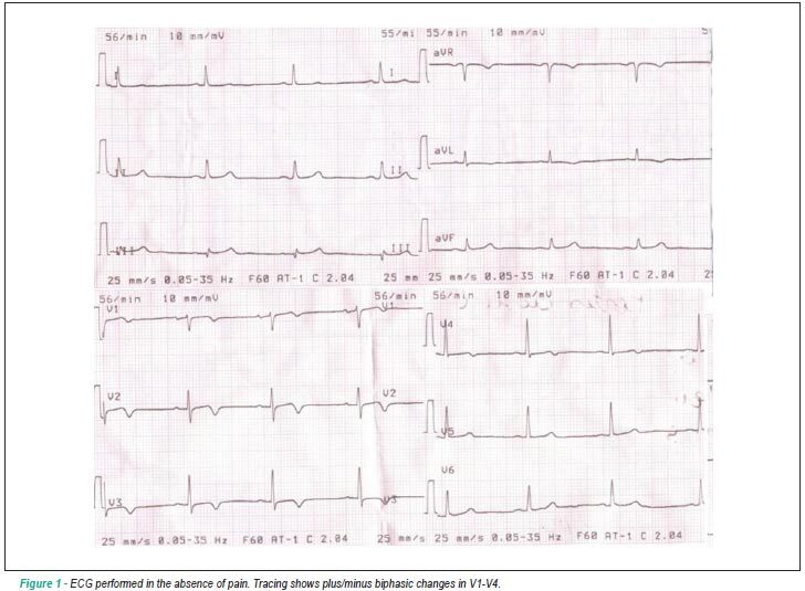 Wellens syndrome