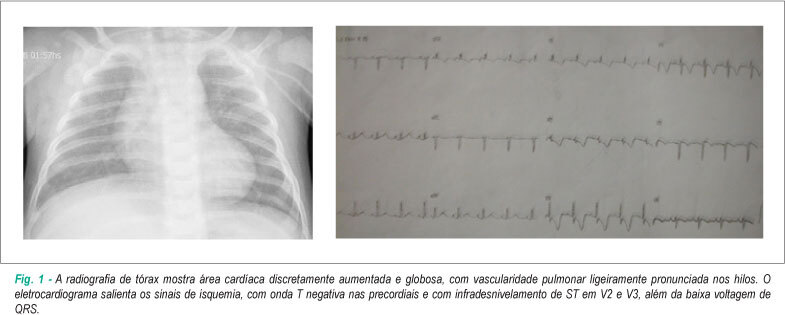 Imagem 1 da galeria