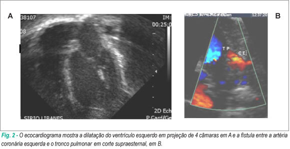 Imagem 2 da galeria