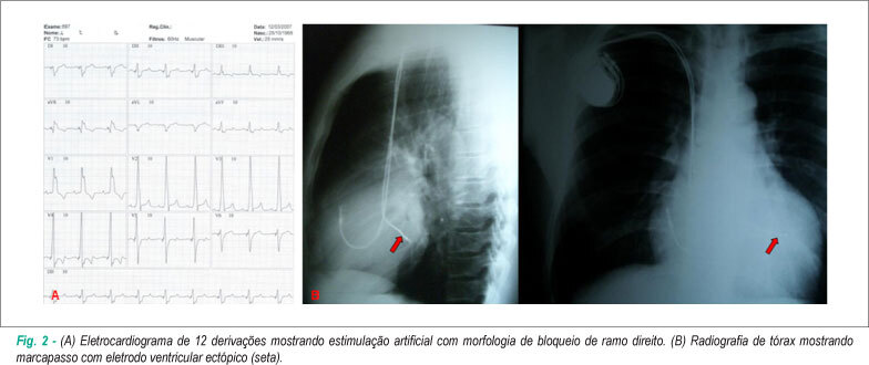 Imagem 2 da galeria