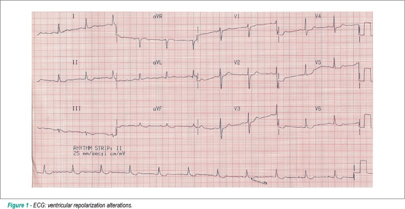Case 3: Elderly female patient with acute myocardial infarction presenting sudden shock during thrombolytic treatment