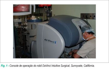 Dissecção robótica da artéria torácica interna direita por esternotomia mediana