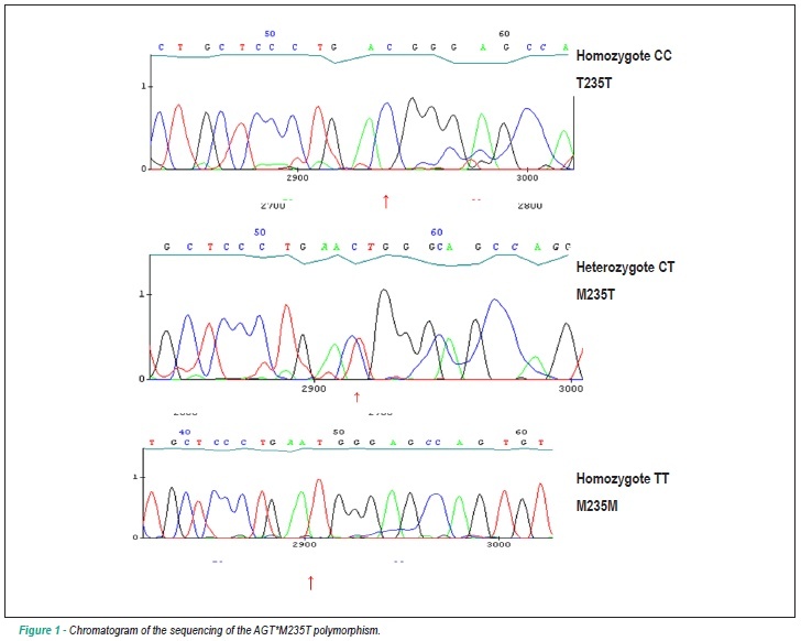 AGT*M235T polymorphism in acute ischemic cardiac dysfunction: the gisca project
