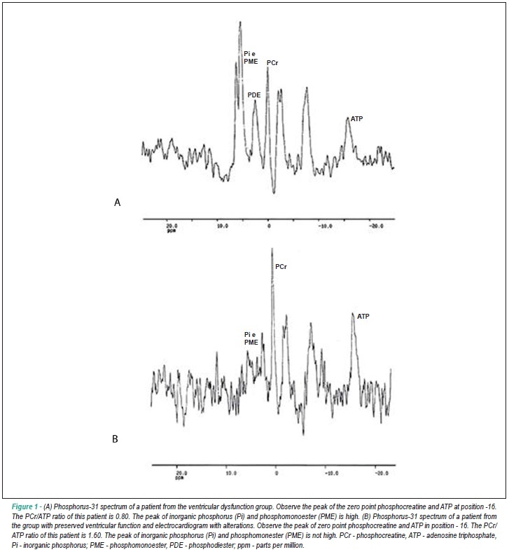Evaluation of the metabolism of high energy phosphates in patients with Chagas' disease